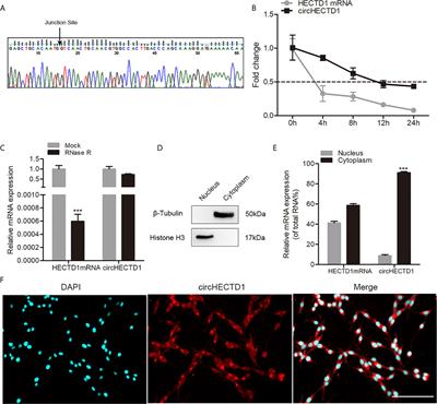 CircHECTD1 Regulates Cell Proliferation and Migration by the miR-320-5p/SLC2A1 Axis in Glioblastoma Multiform